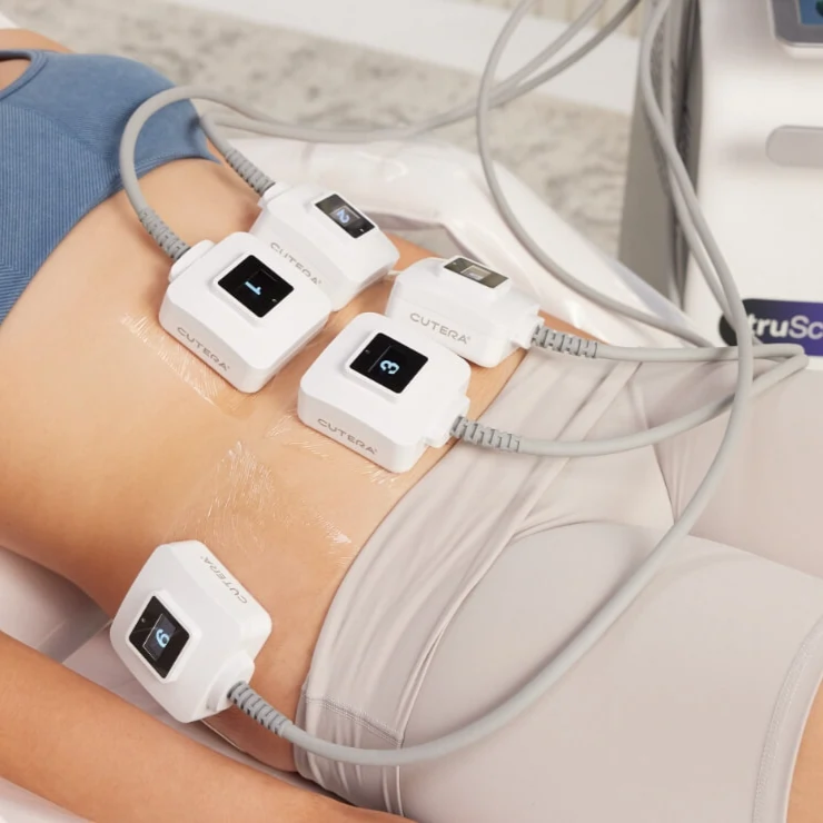 Trusculpt technology