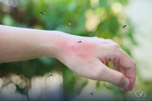Dust Mite Allergies: Understanding and Minimizing the Risks