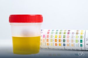 Urine Color: Decoding Its Messages for Your Health