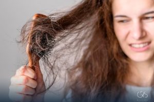 Uncombable Hair Syndrome: Understanding the Condition