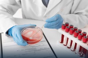 Understanding Blood Clot Detection: A Comprehensive Guide