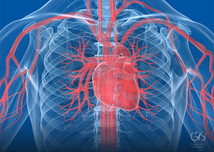 Diabetes impact on Cardiovascular System :