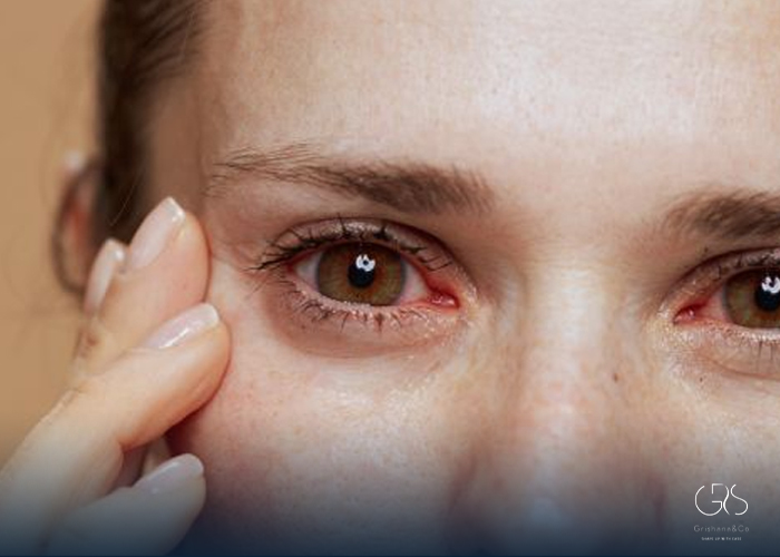 Pink Eye Treatments