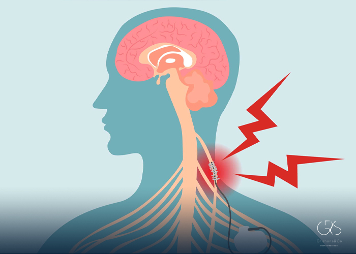 Vagus Nerve Stimulation for Inflammatory Disorders