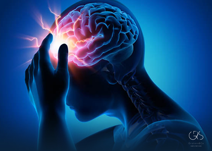 Vagus Nerve Stimulation for Migraines