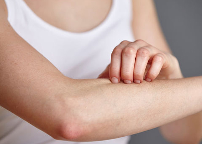 Could Your Itchy Skin be a Sign of Skin Cancer?