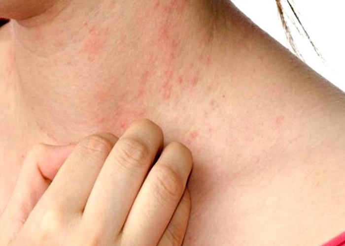 Other Reasons for Itchy Skin