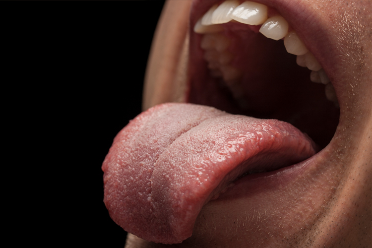 Understanding Oral Cancer