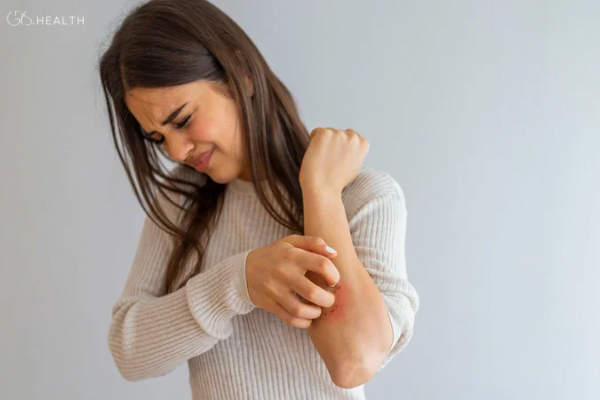 Psoriasis & Other Skin Conditions