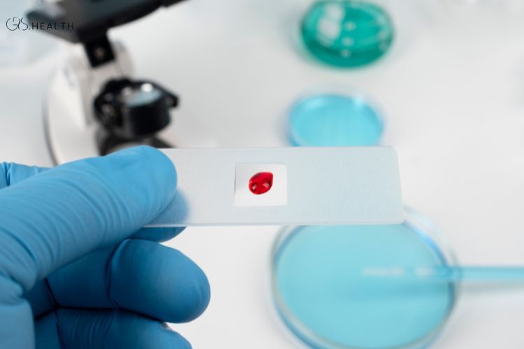What Is a High White Blood Cell Count?