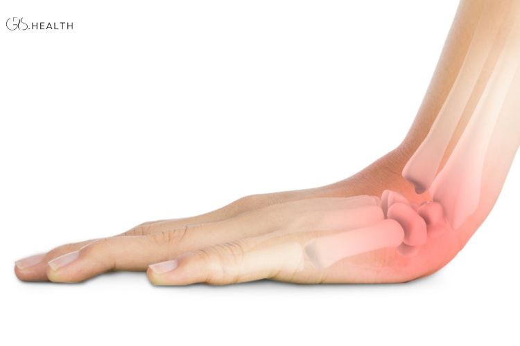 Sprains, contusions, and minor fractures