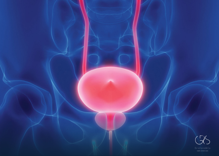 Recovery Timeline and Aftercare