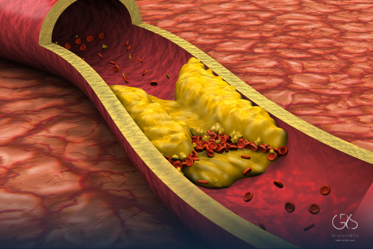 How Much Dietary Cholesterol Intake Is Safe Per Day?