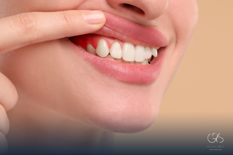 Improving Smile Appearance Safely