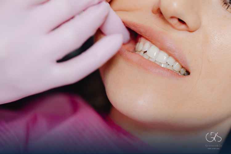 Teeth Cleaning Benefits That Protect Your Health