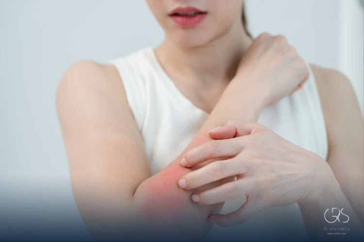 Allergy Rash Treatment That Actually Works