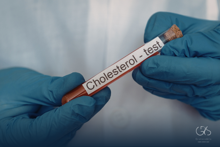 How Cholesterol Effects Body and Health